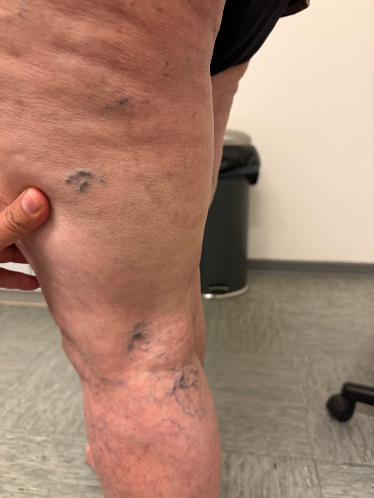 Besenreiser Beispiel