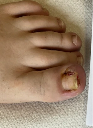 Besenreiser Beispiel