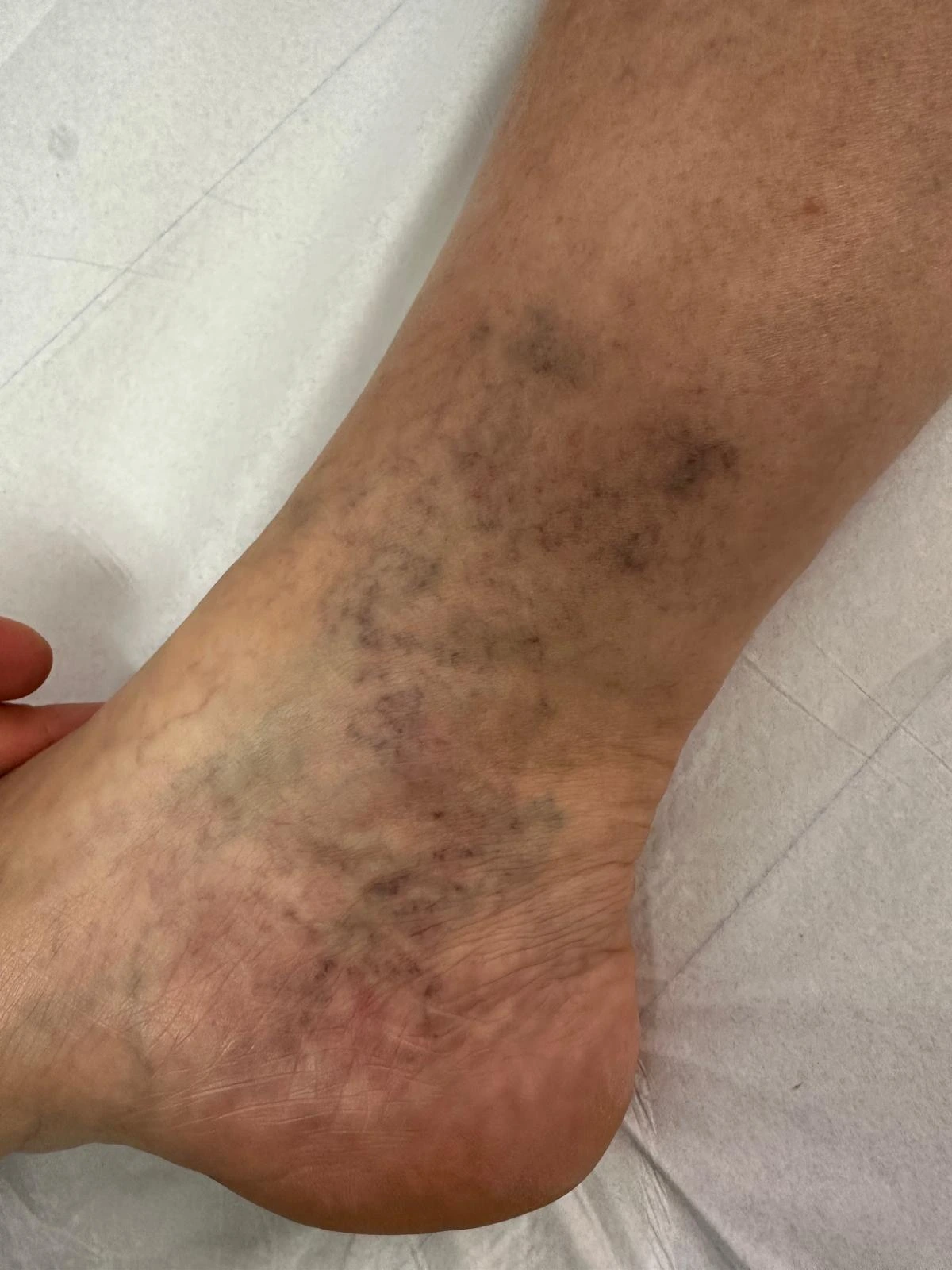 Besenreiser Beispiel